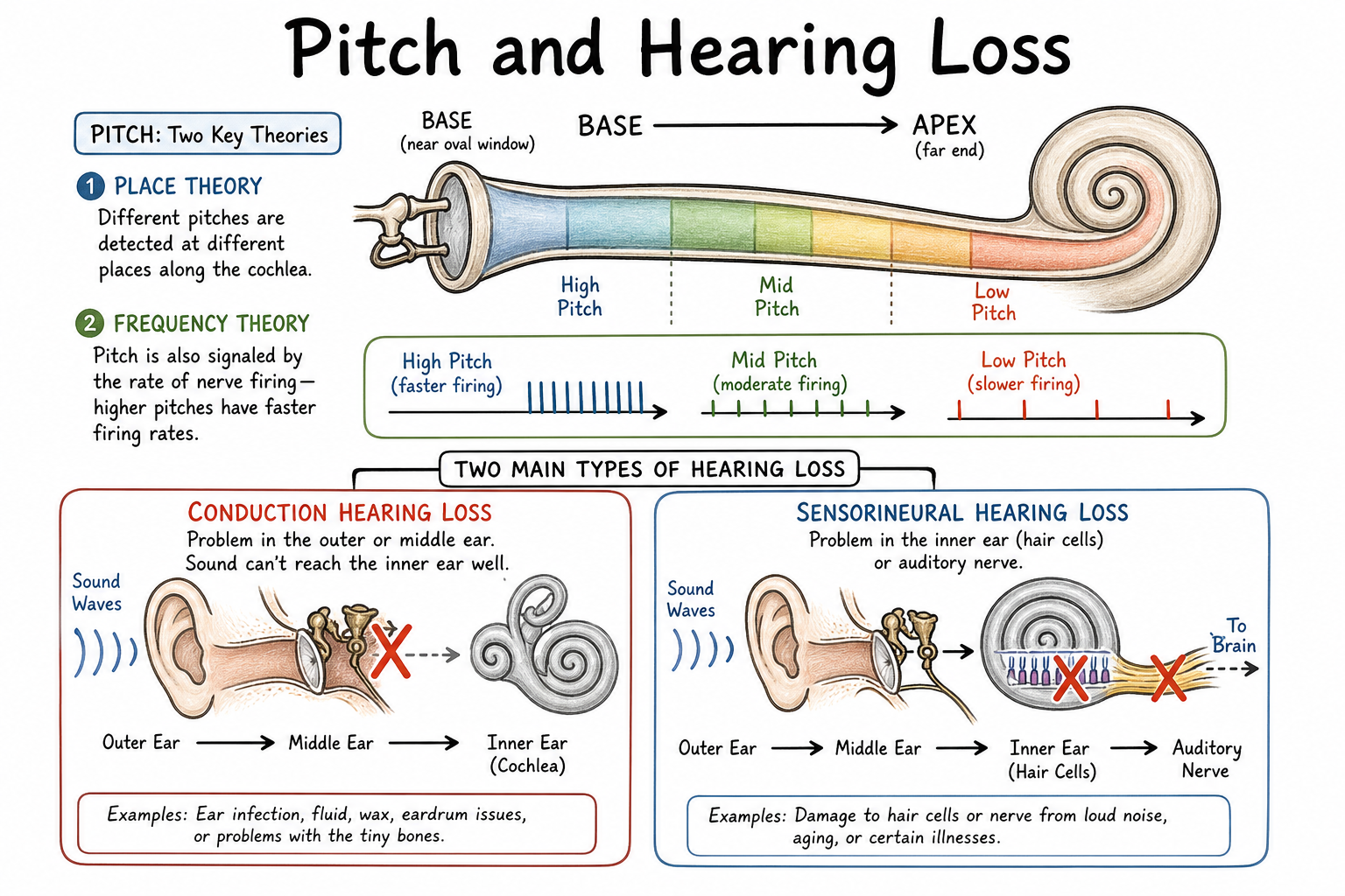 A diagram explaining place theory, frequency theory, conduction hearing loss, and sensorineural hearing loss.